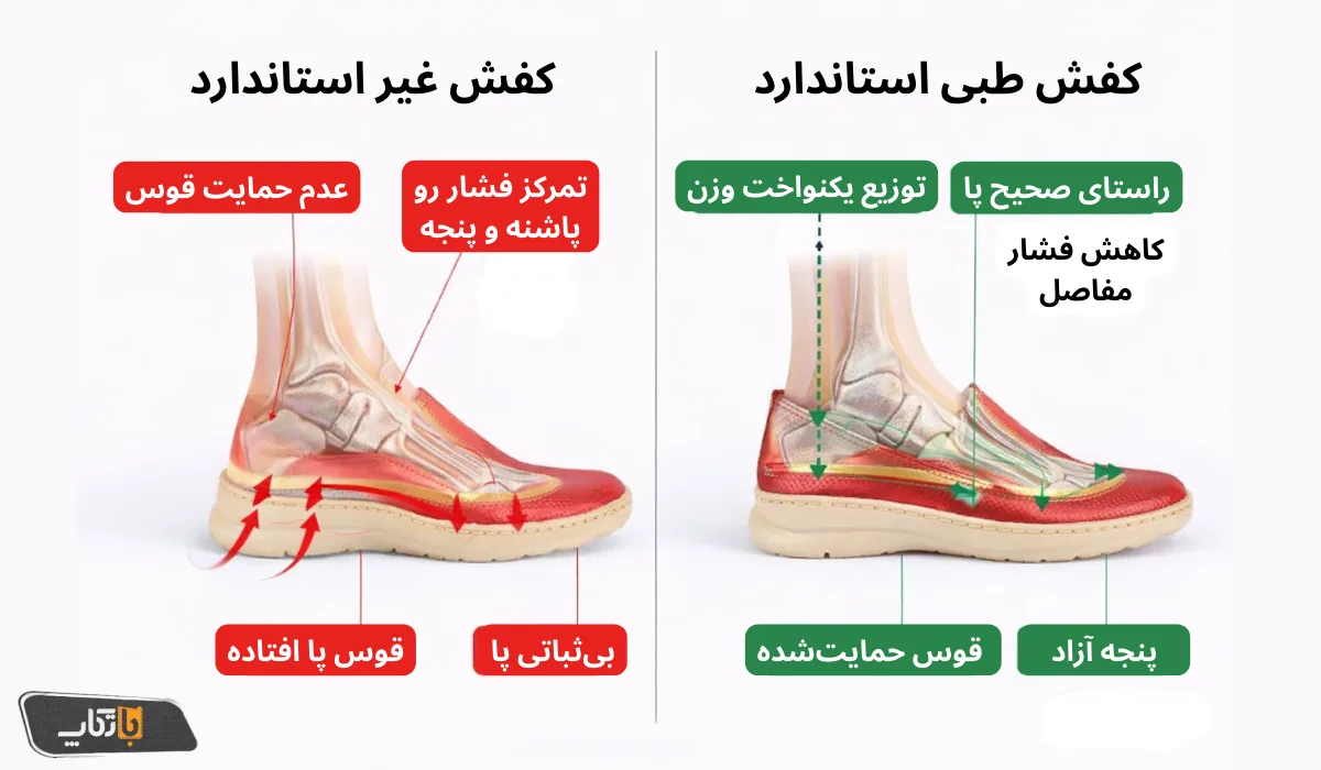 مقایسه علمی کفش طبی استاندارد vs کفش معمولی